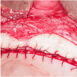 Formation IFIP tissus mous peri-implantaires (9)